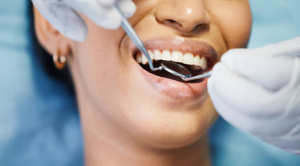 Best Cosmetic Emergency Dentistry in Cottonwood Heights, UT